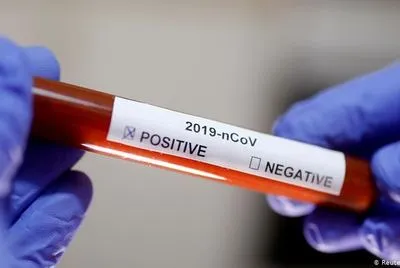 В ВОЗ рассказали, как остановить коронавирус: тестируйте каждый подозрительный случай