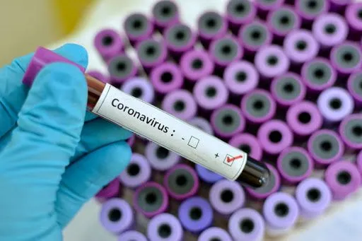 В Киеве зафиксировано 2 случая коронавируса