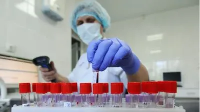На Житомирщині немає нових випадків зараження коронавірусом - ОДА