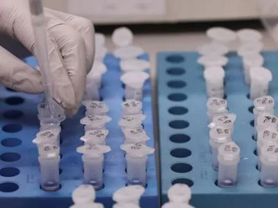 Центральная государственная лаборатория проверяет на коронавирус 15 человек из Буковины