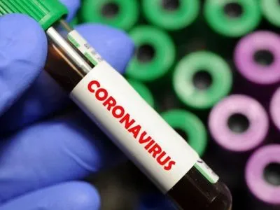На Дніпропетровщині на коронавірус перевіряють 11 осіб