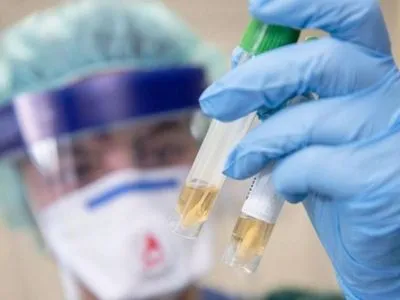 На Київщині закупили 25 тест-систем для виявлення коронавірусу