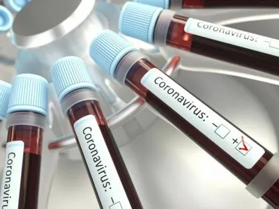 Украина получила первую партию отечественных экспресс-тестов на коронавирус