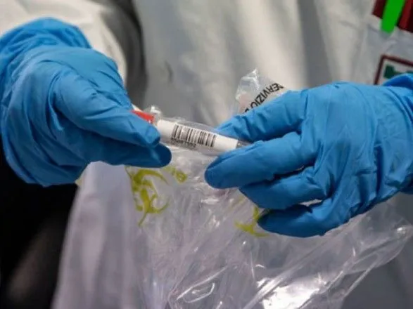 На Житомирщині шістьох пацієнтів перевіряють на коронавірус