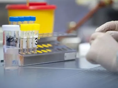 Лабораторні дослідження не виявили коронавірусу у 58-річної житомирянки