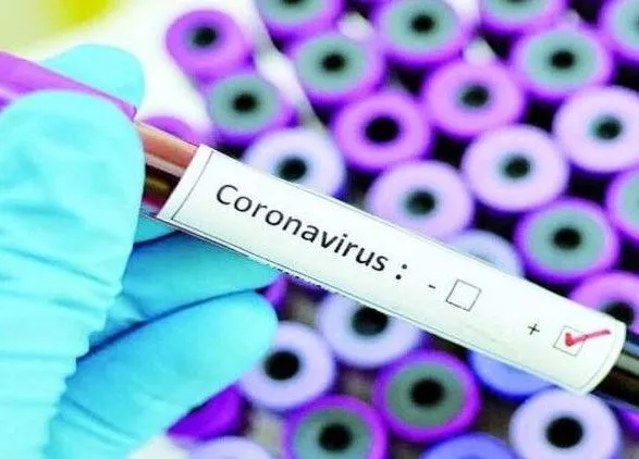 koronavirus-v-ukrayini-zhinka-z-sumschini-v-yakoyi-viyavili-covid-19-pomerla-u-likarni