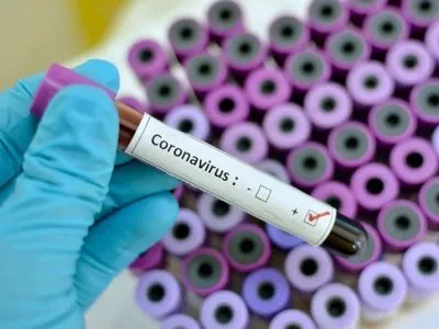 Еще один случай коронавируса обнаружили в Днепропетровской области