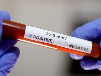На Львівщині 57 пацієнтів з підозрою на коронавірус знаходяться на самоізоляції