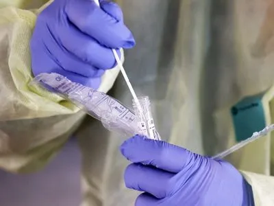 У женщины, которая находится на обсервации в Днепропетровской области, экспресс-тест показал коронавирус