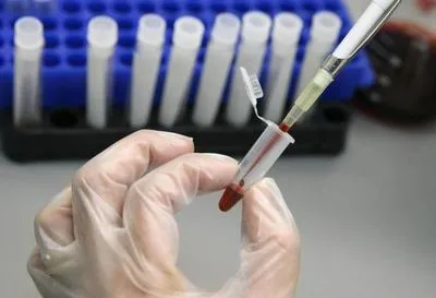 У МОЗ прокоментували неповідомлення про позитивні тести на коронавірус приватною клінікою