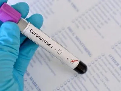 В Хмельницкой области лабораторно подтверждено 10 случаев заболевания COVID-19
