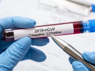 В Ивано-Франковске получили уже более 80 положительных тестов на коронавирус