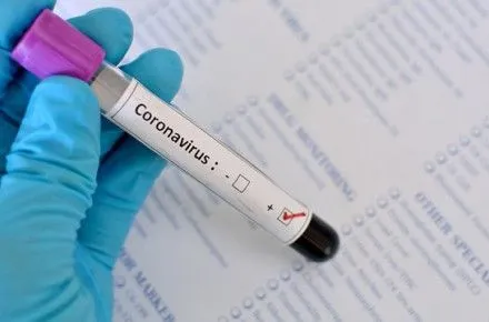 na-lvivschini-zafiksuvali-odinadtsyat-zakhvoryuvan-na-koronavirus