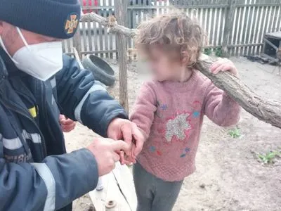 На Херсонщині 6-річна дівчинка наділа на палець шайбу і не змогла зняти: викликали рятувальників