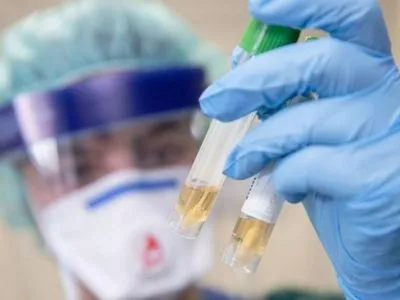 На Одещині підтвердили ще 20 випадків захворювання на коронавірус