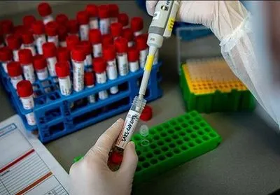 На Дніпропетровщині виявили шість нових випадків коронавірусу