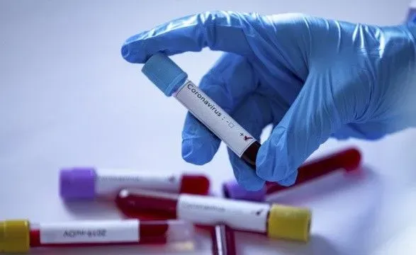 В Ровенской области подтверждено 12 новых случаев коронавируса