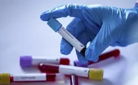 На Рівненщині підтверджено 12 нових випадків коронавірусу