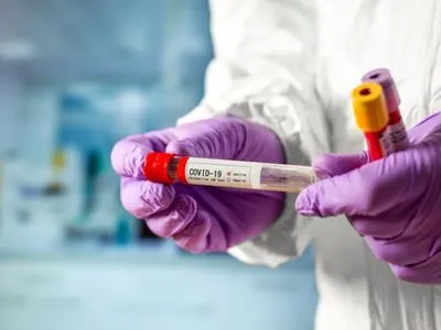 Коронавірус на Полтавщині виявили у 34 медиків