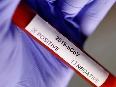 На підприємстві "Укроборонпрому" виявили 4 випадки коронавірусу
