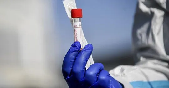 В Киевской области обнаружили 30 новых случаев коронавируса