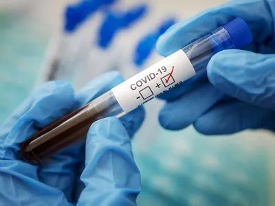 В Хмельницкой области зафиксировали 116 случаев коронавируса