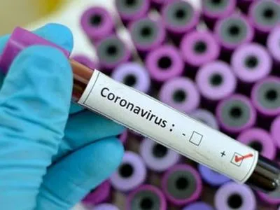 В Украине уже зафиксировано 11913 случаев COVID-19, из них 288 - летальные