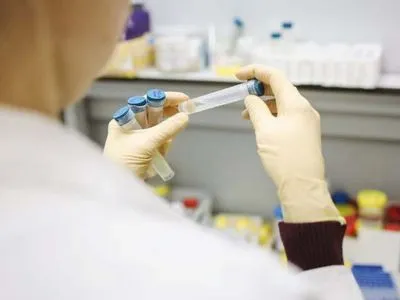 За сутки в Украине совершили более 8,9 тыс. ПЦР-тестов на коронавирус