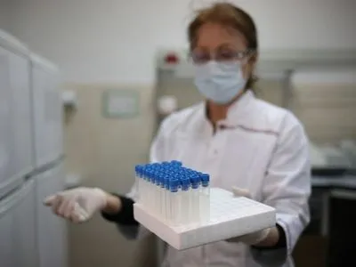 МОЗ: за добу в Україні 325 нових інфікування коронавірусом