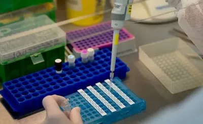 На Буковині виявили 58 нових випадків коронавірусу