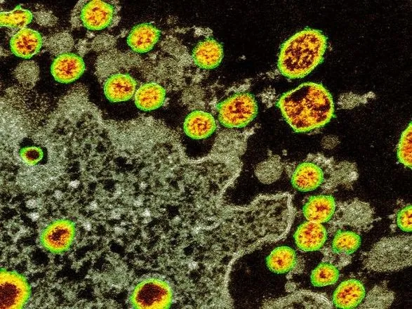 Еволюція пандемічного коронавірусу проклала шлях від тварин до людини - дослідники