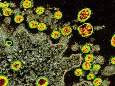 Еволюція пандемічного коронавірусу проклала шлях від тварин до людини - дослідники