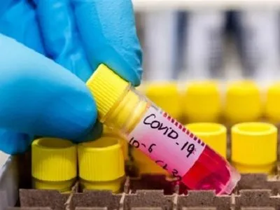 Без нових антирекордів: за добу в Україні коронавірус виявили у 841 людини