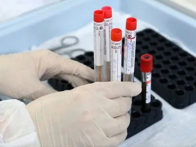 Украина вышла на уровень Польши и Чехии по уровню тестирование на коронавирус - Шмыгаль