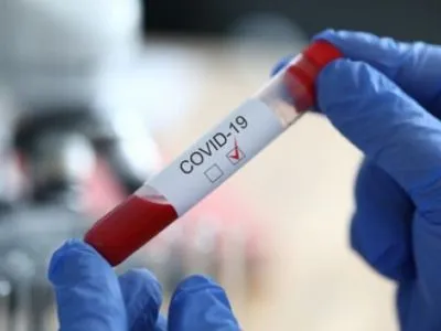 Больше всего новых случаев COVID-19 обнаружили в Дарницком районе столицы