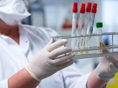 Кількість нових випадків коронавірусу на Львівщині за добу впала до 82