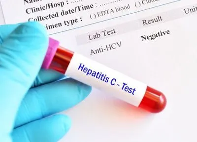 Гепатит С часто виявляють у людей без симптомів – лікар