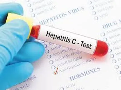 В Україні невиліковним гепатитом В інфіковано втричі більше людей, ніж гепатитом С