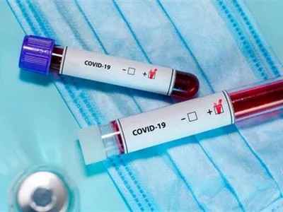 У ЦВК виявили випадок захворювання на коронавірусну хворобу