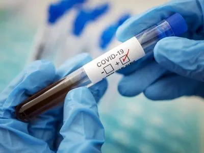 У Херсоні придбали неякісні тести на COVID-19 на понад 2 млн грн