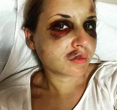У женщины, которую избили в поезде "Мариуполь-Киев", ухудшилось состояние здоровья