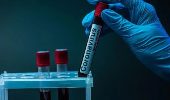 За сутки в Украине коронавирус обнаружен у 55 медиков