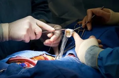 В Минздраве планируют включить "Черкасский кардиодиспансер" в пилотный проект по трансплантации