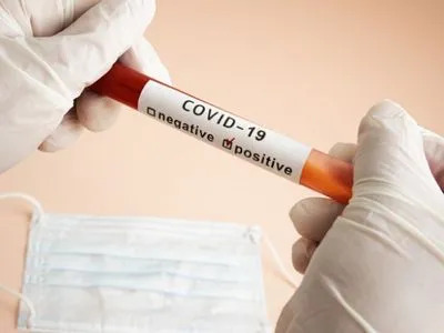 За добу в Україні на COVID-19 захворіло 127 дітей та 120 медпрацівників