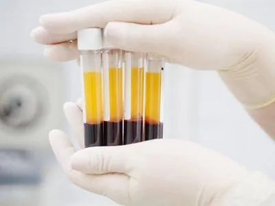 У США провели понад 35 тис. переливань плазми крові людей, які перехворіли на COVID-19