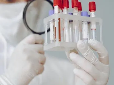 Одесситы жалуются на поборы в больницах за непредусмотренные ПЦР-тесты на коронавирус