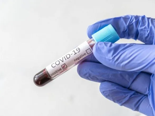 Новые тесты на коронавирус: что нужно знать и в чем разница