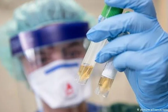 МОЗ будет наращивать объемы "ковид"-тестирования и введет тест на антиген