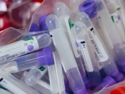 До грудня МОЗ планує збільшити кількість ПЛР-тестувань на коронавірус