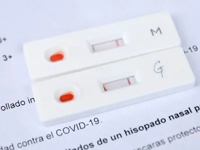 Антитела у человека, который переболел COVID-19, через некоторое время исчезают — врач